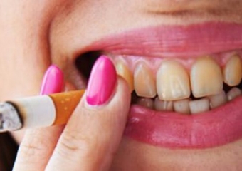 Sigaranın Ağız ve Diş Sağlığına Etkileri