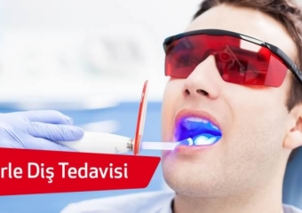 Lazer Destekli Diş Tedavileri Nelerdir?