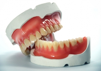 Diş Protezi Nedir? Türleri Nedir? Nasıl Takılır?